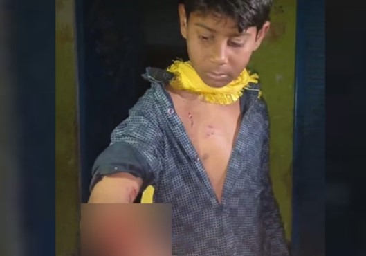 हमीरपुर में रॉटविलर का कहर: मासूम को बुरी तरह नोचा, सुप्रीम कोर्ट के आदेशों को ठेंगा दिखा रहे कुत्ता मालिक